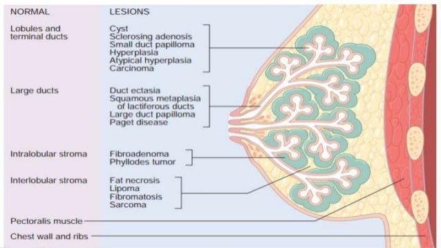 papilloma breast lump Scobby doo xxx